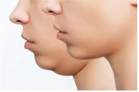 How to lose fat in your face