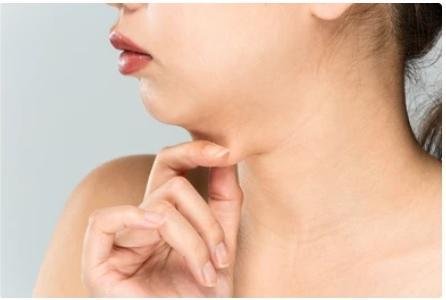 How Long Does It Take to Lose Face Fat